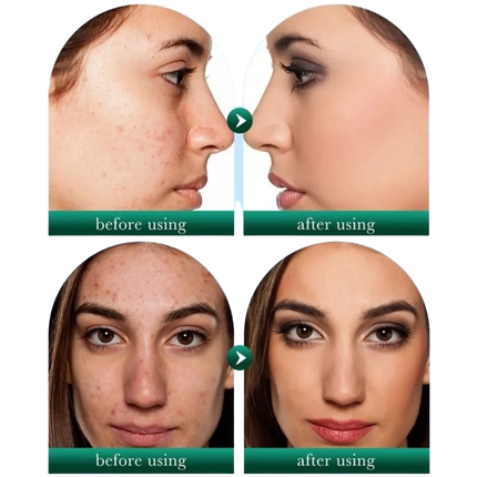 Nettoyant visage